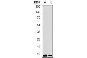 Western blot analysis of UBCH5 expression in SW620 (A), BT474 (B) whole cell lysates. (UBE2D1 anticorps)