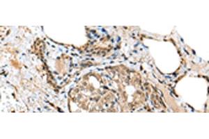 anti-Tubulin Polymerization Promoting Protein (Tppp) antibody