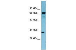 WB Suggested Anti-RASL12 Antibody Titration: 0. (RASL12 anticorps  (N-Term))