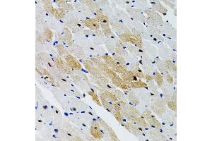 Immunohistochemistry of paraffin-embedded rat heart using SHP2 antibody (ABIN3016706, ABIN3016707, ABIN3016708 and ABIN6219822) at dilution of 1:100 (40x lens).