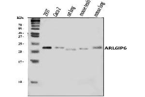 Western blot analysis of ARL6IP6 using anti-ARL6IP6 antibody (ABIN7603020).