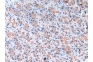 Detection of TOR3A in Rat Stomach Tissue using Polyclonal Antibody to Torsin 3A (TOR3A)