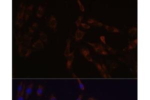 Immunofluorescence analysis of C6 cells using SUCLG2 Polyclonal Antibody at dilution of 1:100 (40x lens).