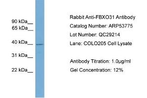 WB Suggested Anti-FBXO31  Antibody Titration: 0. (FBXO31 anticorps  (Middle Region))