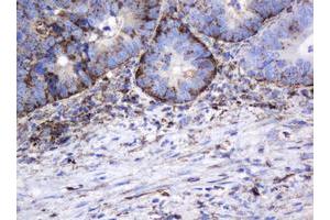 Image no. 11 for anti-Galactosidase, beta 1 (GLB1) antibody (ABIN1498467)