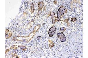 IHC analysis of GALE using anti-GALE antibody . (GALE anticorps  (AA 1-340))