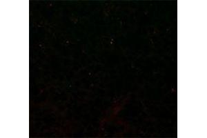 Immunofluorescence (IF) image for anti-Integrin, alpha X (Complement Component 3 Receptor 4 Subunit) (ITGAX) antibody (Alexa Fluor 647) (ABIN2657619)