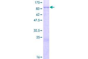 Image no. 1 for Leucine Rich Repeat Neuronal 2 (LRRN2) (AA 1-713) protein (GST tag) (ABIN1309821)