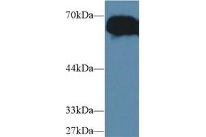 Detection of AFP in Mouse Serum using Polyclonal Antibody to Alpha-Fetoprotein (AFP)