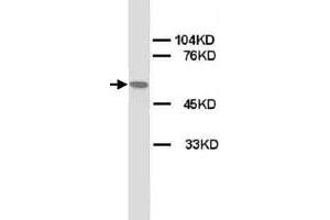 Western Blot analysis of CHRNA1 expression from rat skeletal muscle lyate with CHRNA1 polyclonal antibody . (CHRNA1 anticorps  (N-Term))