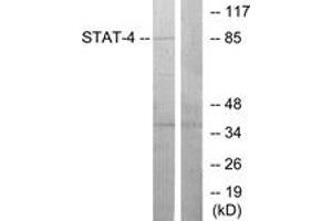 Western blot analysis of extracts from HeLa cells, using STAT4 (Ab-693) Antibody. (STAT4 anticorps  (AA 660-709))