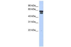BLMH antibody used at 1 ug/ml to detect target protein. (BLMH anticorps  (Middle Region))