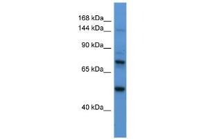 WB Suggested Anti-ASTN2 Antibody Titration:  0. (Astrotactin 2 anticorps  (N-Term))