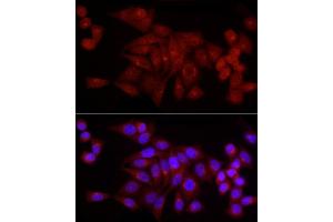 Immunofluorescence analysis of HeLa cells using SNRPD1 Rabbit pAb (ABIN7270363) at dilution of 1:50 (40x lens). (SNRPD1 anticorps  (AA 1-100))