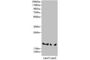 Western blot All lanes: BLOC1S6 antibody at 3.