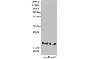 Western blot All lanes: BLOC1S6 antibody at 3. (Pallidin anticorps  (AA 1-170))