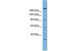 WB Suggested Anti-DIP2A Antibody Titration:  0. (DIP2A anticorps  (N-Term))