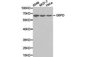 Western Blotting (WB) image for anti-Glucose-6-Phosphate Dehydrogenase (G6PD) antibody (ABIN1872757) (Glucose-6-Phosphate Dehydrogenase anticorps)
