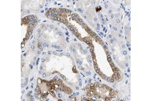 Annexin A3 Antibody for IHC in human kidney tissue