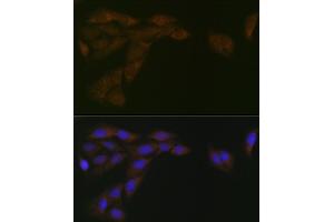 Immunofluorescence analysis of U-2 OS cells using CYPOR Rabbit mAb (ABIN7269151) at dilution of 1:100 (40x lens). (POR anticorps)