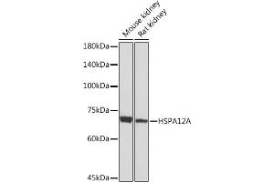 Western blot analysis of extracts of various cell lines, using HSPA Rabbit mAb (ABIN7267576) at 1:1000 dilution. (HSPA12A anticorps)