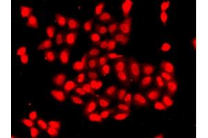 Immunofluorescence analysis of A549 cells using CAMK1D antibody (ABIN5975586). (CAMK1D anticorps)