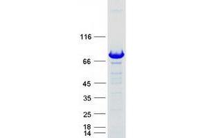 Validation with Western Blot