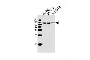 Lane 1: Jurkat Cell lysates, Lane 2: MCF-7 Cell lysates, Lane 3: NIH/3T3 Cell lysates, probed with RPS6KB2 (164CT21.