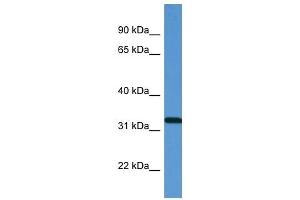 Western Blot showing ZAP70 antibody used at a concentration of 1 ug/ml against Fetal Lung Lysate (ZAP70 anticorps  (N-Term))
