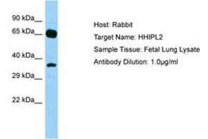 Image no. 1 for anti-HHIP-Like 2 (HHIPL2) (AA 606-655) antibody (ABIN6750191) (HHIPL2 anticorps  (AA 606-655))