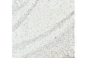 IHC analysis of SFPQ using anti-SFPQ antibody (ABIN7603089). (SFPQ anticorps  (Middle Region))
