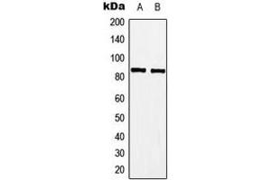 Western blot analysis of A-MYB expression in Jurkat (A), Raw264. (MYBL1 anticorps  (Center))