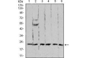 Western blot analysis using RAN mouse mAb against A431 (1), C6 (2), Jurkat (3), Hela (4), COS7 (5), and Jurkat (6) cell lysate. (RAN anticorps  (AA 1-216))