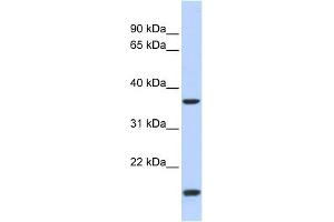 WB Suggested Anti-ZIC4 Antibody Titration:  0. (ZIC4 anticorps  (N-Term))