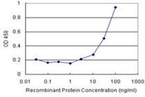 MVD (Human) Matched Antibody Pair