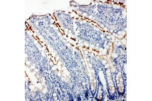Anti-Zonula occludens protein 3 antibody, IHC(P) IHC(P): Rat Intestine Tissue (TJP3 anticorps  (C-Term))
