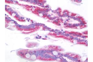 Anti-SCNN1B / ENaC Beta antibody IHC staining of human intestine. (SCNN1B anticorps  (AA 306-332))