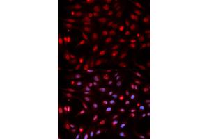 Immunofluorescence analysis of HeLa cells using APEX1 antibody.