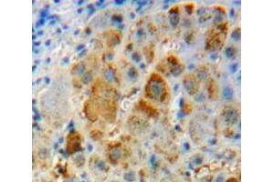 Used in DAB staining on fromalin fixed paraffin- embedded liver tissue (IL-11 anticorps  (AA 22-199))