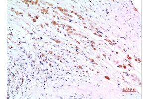 Immunohistochemistry (IHC) analysis of paraffin-embedded Human Brain, antibody was diluted at 1:100.