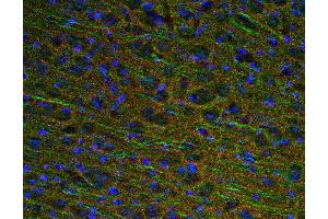 Indirect immunostaining of PFA fixed mouse brain section with anti-GAP 43 (dilution 1 : 500; red) and rabbit anti-MAP 2 (cat.