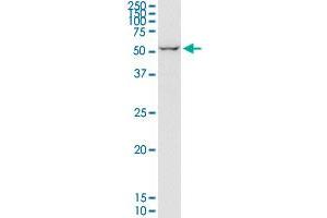 EIF2D monoclonal antibody (M05), clone 2D10. (EIF2D anticorps  (AA 485-584))