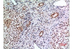 Immunohistochemistry (IHC) analysis of paraffin-embedded Human Liver, antibody was diluted at 1:100.