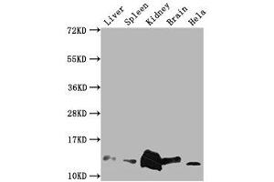 Western Blot Positive WB detected in: Mouse Liver tissue, Mouse Spleen tissue, Mouse kidney tissue, Mouse Brain tissue, Hela whole cell lysate All lanes: Mif antibody at 1:2000 Secondary Goat polyclonal to rabbit IgG at 1/50000 dilution Predicted band size: 13 kDa Observed band size: 13 kDa