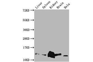 Western Blot Positive WB detected in: Mouse Liver tissue, Mouse Spleen tissue, Mouse kidney tissue, Mouse Brain tissue, Hela whole cell lysate All lanes: Mif antibody at 1:2000 Secondary Goat polyclonal to rabbit IgG at 1/50000 dilution Predicted band size: 13 kDa Observed band size: 13 kDa (MIF anticorps  (AA 2-115))