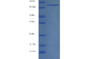 SDS-PAGE (SDS) image for Myosin Heavy Chain 6, Cardiac Muscle, alpha (MYH6) (AA 160-816), (partial) protein (His tag) (ABIN5713688)