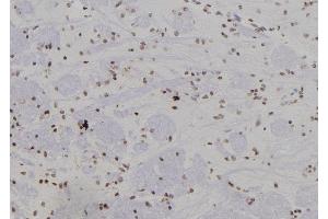 ABIN6277441 at 1/100 staining Rat brain tissue by IHC-P.