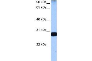 WB Suggested Anti-STAU1  Antibody Titration: 0.