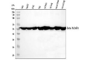 Western blot analysis of Tubulin beta using anti-Tubulin beta antibody (ABIN7602744).