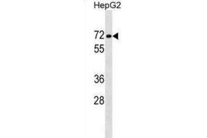 Western Blotting (WB) image for anti-Protein Phosphatase 1, Regulatory Subunit 16B (PPP1R16B) antibody (ABIN2999569) (PPP1R16B anticorps)